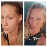 Holi (Growth) 84 Leave-In Hair Growth Scalp Spray