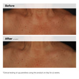 Niacinamide 5% Face And Body Emulsion