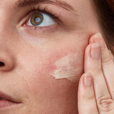 Clean Beauty Skin Care For Rosacea