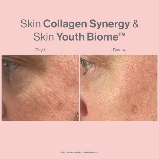 Skin Collagen Synergy - Reduces Signs of Aging