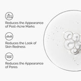 Aloe 2% + NAG 2% Solution